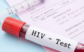 Δωρεάν εξέταση HIV στο Πολυδύναμο Δημοτικό Ιατρείο Κυψέλης