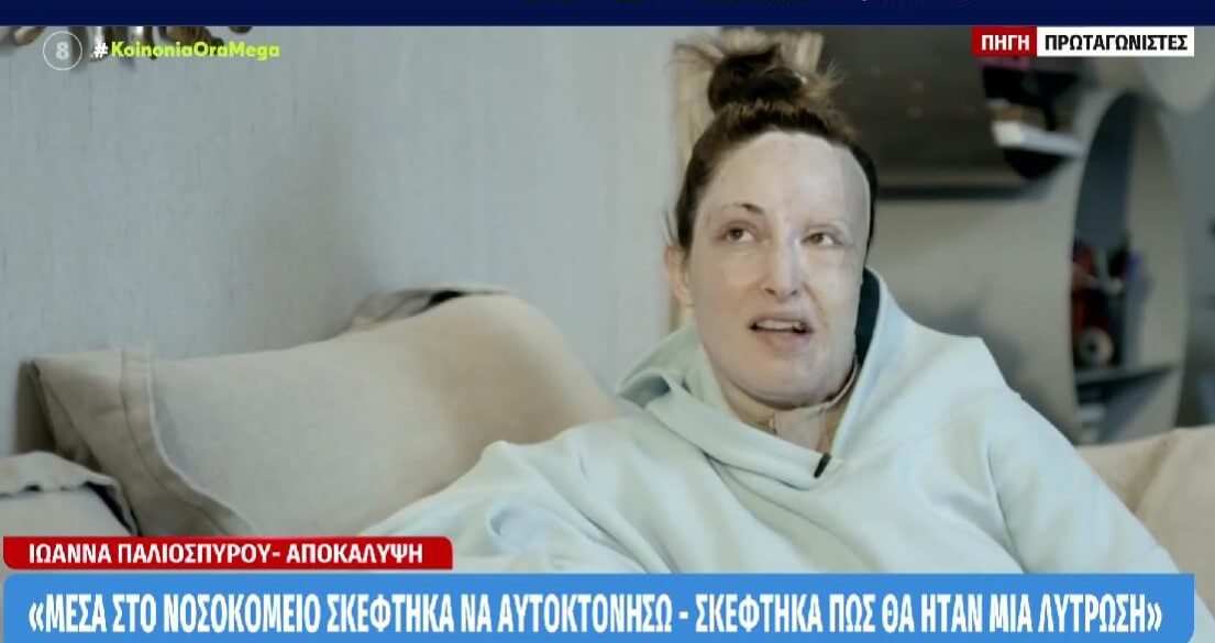 Ιωάννα Παλιοσπύρου: Έδειξε το πρόσωπό της & περιέγραψε τις δραματικές στιγμές της επίθεσης με βιτριόλι
